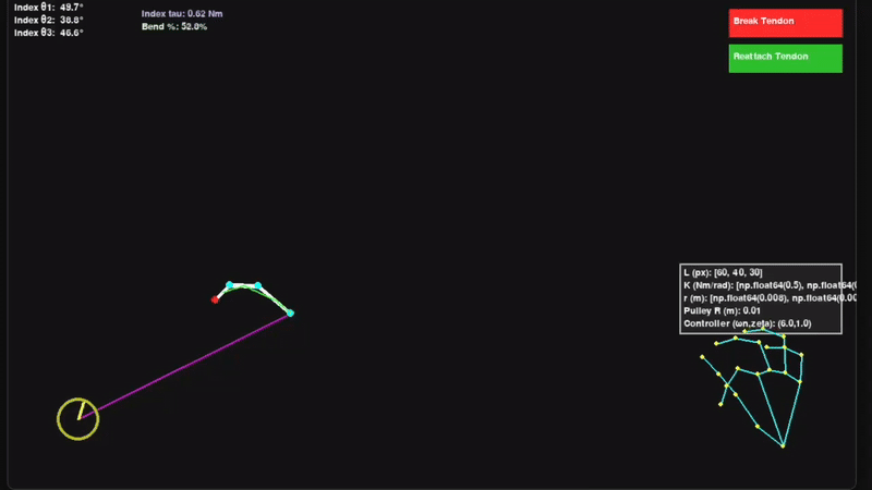 Vision based— Gesture-Controlled Robotic Finger